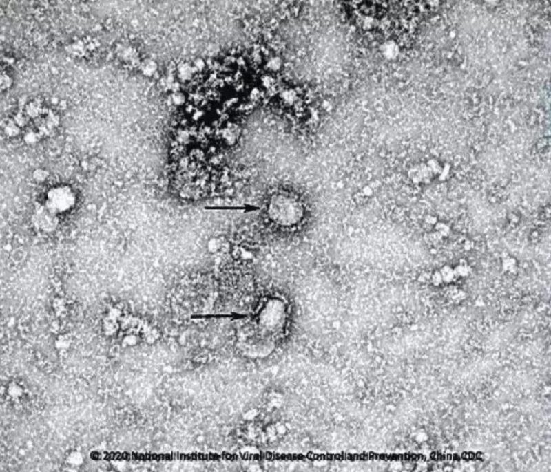 ▲新型冠狀病毒武漢株01。照片來源：國家病原微生物資源庫（中國疾病預防控制中心病毒病預防控制所）
